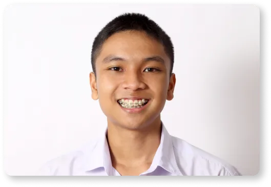 a young man with braces on his teeth